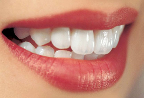 Chia sẻ kinh nghiệm bọc răng sứ hiệu quả Boc-rang-su-cercon-gia-bao-nhieu