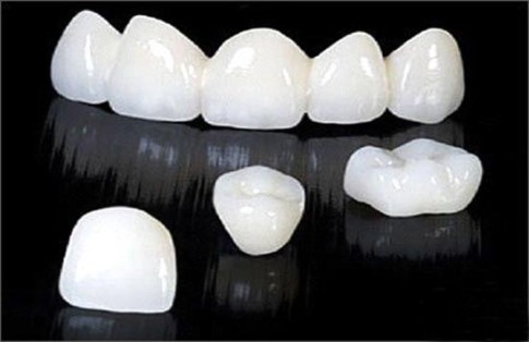 Sức khỏe, đời sống: Các biến chứng có thể xảy ra khi bọc răng sứ Cac-loai-rang-su-hien-nay