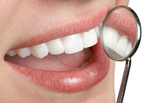 Đâu là giải pháp tốt nhất cho răng cửa bị sứt mẻ? Rang-su-emax-la-gi
